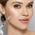 Morpheus8 vs Scarlet RF: Which is the Better Microneedling Treatment?