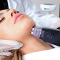 Morpheus8: The Best Microneedling Treatment for Skin Rejuvenation