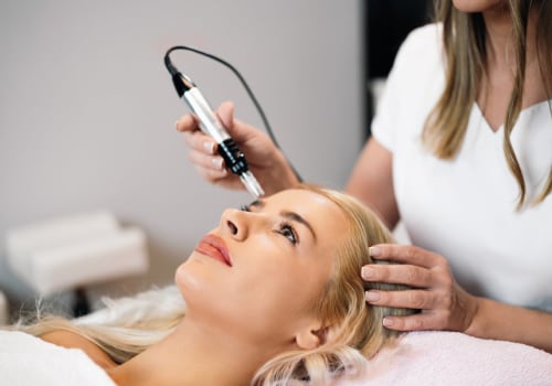 The Ultimate Guide to Morpheus8 and Microneedling: Which is Better?