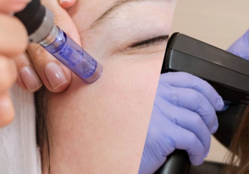 Morpheus8 vs SkinPen: Which Microneedling Treatment is Right for You?